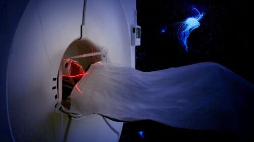 Psilocybin Study Scanner